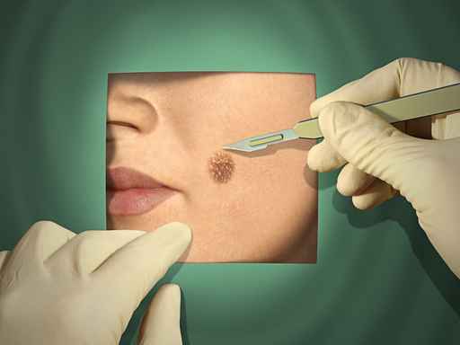 Virus Infektion Gesichtshaut Behandlung